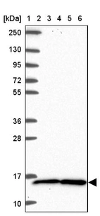Lane 1: Marker [kDa] 250, 130, 95, 72, 55, 36, 28, 17, 10_br/_Lane 2: Human cell line RT-4_br/_Lane 3: Human cell line U-251 MG_br/_Lane 4: Human plasma_br/_Lane 5: Human Liver tissue_br/_Lane 6: Human Tonsil tissue
