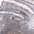 Immunohistochemical staining of human rectum shows strong nuclear positivity in glandular cells and lymphoid cells.