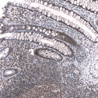 Immunohistochemical staining of human rectum shows strong nuclear positivity in glandular cells and lymphoid cells.