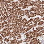 Immunohistochemical staining of human heart muscle shows strong cytoplasmic positivity in cardiomyocytes.