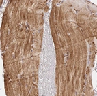 Immunohistochemical staining of human skeletal muscle shows moderate cytoplasmic positivity in myocytes.