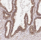 Immunohistochemical staining of human prostate shows moderate granular cytoplasmic positivity in glandular cells.