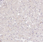 Immunohistochemical staining of human liver shows only very weak positivity in hepatocytes as expected.