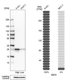 Western blot analysis in human cell lines A-431 and MCF-7 using Anti-GBAS antibody. Corresponding GBAS RNA-seq data are presented for the same cell lines. Loading control: Anti-PPIB.