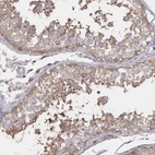 Anti-PGAP2 Antibody