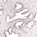 Anti-SMARCB1 Antibody