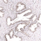 Immunohistochemical staining of human prostate shows moderate nuclear positivity in glandular cells.