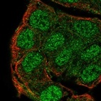 Anti-PTPN13 Antibody