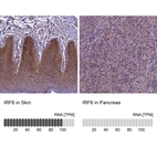 Anti-IRF6 Antibody
