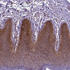 Immunohistochemical staining of human skin shows strong nuclear positivity in squamous epithelial cells.