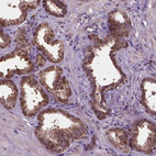 Immunohistochemical staining of human prostate shows strong nuclear positivity in glandular cells.