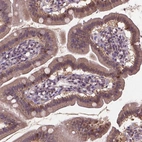 Immunohistochemical staining of human gastrointestinal shows moderate cytoplasmic positivity in glandular cells.