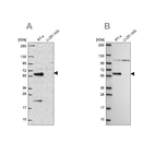 Western blot analysis using Anti-IRF6 antibody HPA063121 (A) shows similar pattern to independent antibody HPA076162 (B).