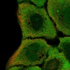 Immunofluorescent staining of human cell line HaCaT shows localization to nucleus, cytosol & cell junctions.