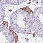 Anti-OR51B5 Antibody