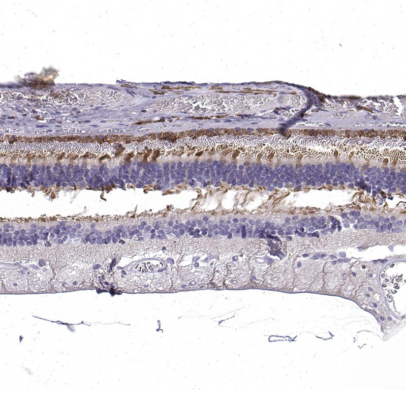 Anti-CRB1 Antibody