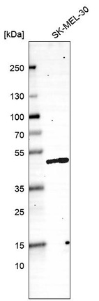 Anti-SMARCB1 Antibody