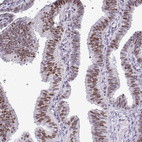 Immunohistochemical staining of human fallopian tube shows moderate nuclear and cytoplasmic positivity in glandular cells.
