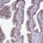 Immunohistochemical staining of human fallopian tube shows moderate nuclear and cytoplasmic positivity in glandular cells.