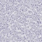 Immunohistochemical staining of human liver shows no positivity in hepatocytes as expected.