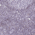 Anti-IRF1 Antibody