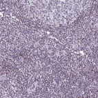 Immunohistochemical staining of human tonsil shows weak nuclear positivity in non-germinal center cells.