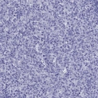 Immunohistochemical staining of human tonsil shows no positivity in lymphoid cells as expected.