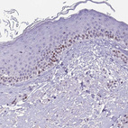 Immunohistochemical staining of human skin shows moderate nuclear positivity in basal squamous epithelial cells.