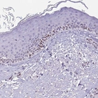 Immunohistochemical staining of human skin shows moderate nuclear positivity in basal squamous epithelial cells.