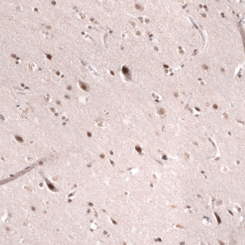 Anti-SMARCB1 Antibody