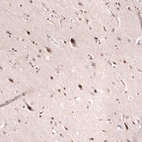 Anti-SMARCB1 Antibody