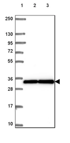 Lane 1: Marker [kDa] 250, 130, 95, 72, 55, 36, 28, 17, 10_br/_Lane 2: Human cell line RT-4_br/_Lane 3: Human cell line U-251 MG