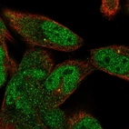 Immunofluorescent staining of human cell line RH-30 shows localization to nucleoplasm, cytosol & centrosome.
