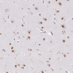 Immunohistochemical staining of human cerebral cortex shows strong nuclear positivity in neuronal cells.