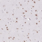 Immunohistochemical staining of human cerebral cortex shows strong nuclear positivity in neuronal cells.
