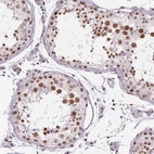 Immunohistochemical staining of human testis shows strong nuclear positivity in cells in seminiferous ducts.