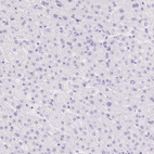 Immunohistochemical staining of human liver shows no nuclear positivity in hepatocytes as expected.