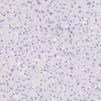 Immunohistochemical staining of human liver shows no nuclear positivity in hepatocytes as expected.
