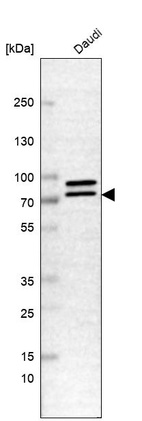 Western blot analysis in human cell line Daudi.