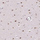 Anti-HNRNPDL Antibody