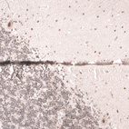 Immunohistochemical staining of human cerebellum shows moderate nuclear positivity in Purkinje cells.