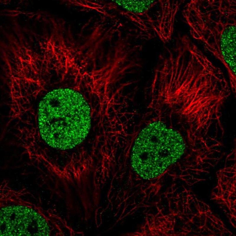 Anti-BNC1 Antibody