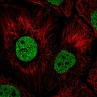 Anti-BNC1 Antibody