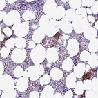 Anti-GP9 Antibody