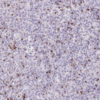 Immunohistochemical staining of human spleen shows strong granular cytoplasmic positivity in cells in red pulp.