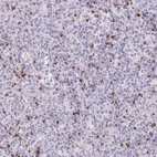 Immunohistochemical staining of human spleen shows strong granular cytoplasmic positivity in cells in red pulp.