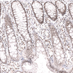 Anti-SMARCB1 Antibody