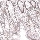 Immunohistochemical staining of human rectum shows moderate nuclear positivity in glandular and lymphoid cells.