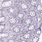 Immunohistochemical staining of human rectum shows weak granular cytoplasmic positivity in leukocytes.