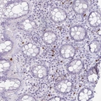 Immunohistochemical staining of human rectum shows weak granular cytoplasmic positivity in leukocytes.